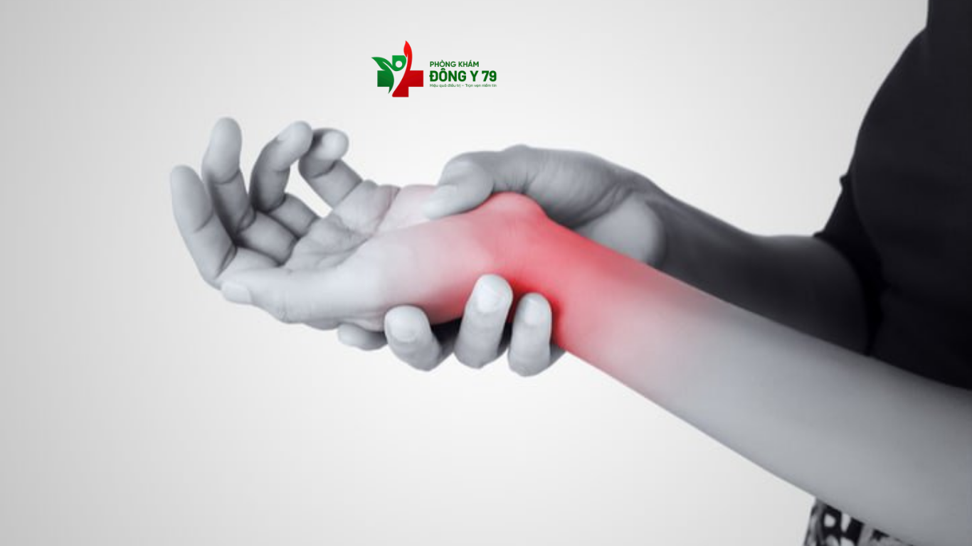 Chấm Dứt Đau Khớp Cổ Tay Nhờ 5 Bí Quyết Tự Nhiên Ngay Tại Nhà