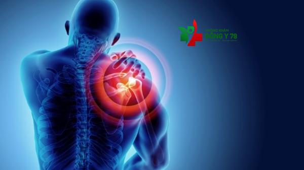 Bạn Hay Bị Đau Mỏi Khớp Vai ? Giải Pháp Hiệu Quả Giúp Phục Hồi Nhanh Chóng