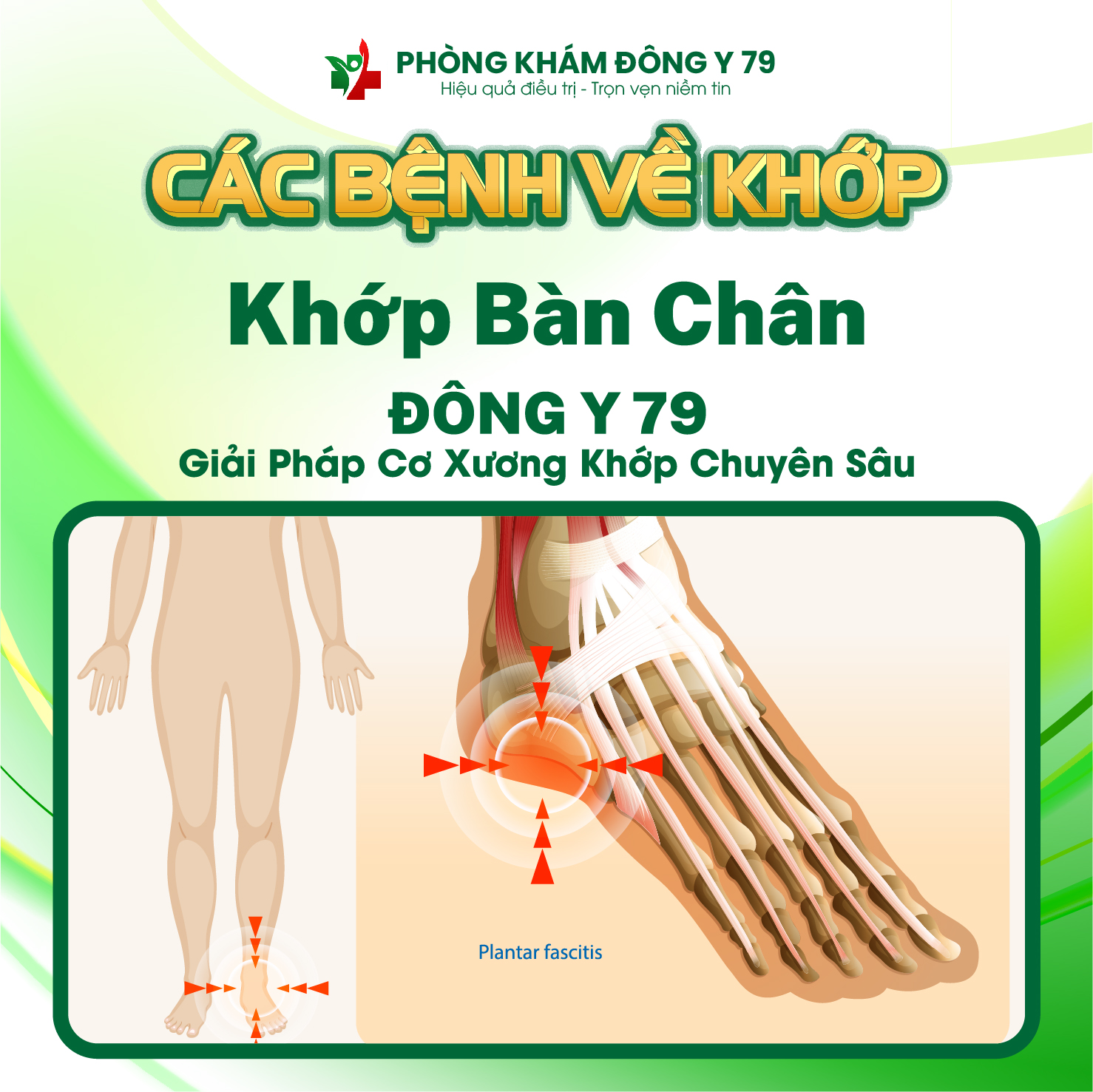 Viêm khớp bàn chân: Dấu hiệu và cách điều trị bằng Đông y tại Đông Y 79