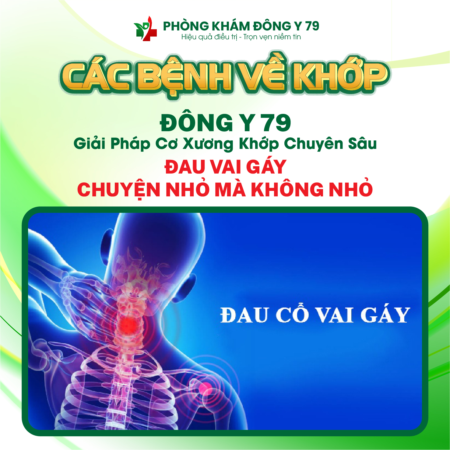 Đau Vai Gáy Mãi Không Hết – 80% Dân Văn Phòng Mắc Mà Không Biết!